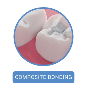 Composite Bonding Hmpg