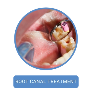 Root Canal Treatment Hmpg