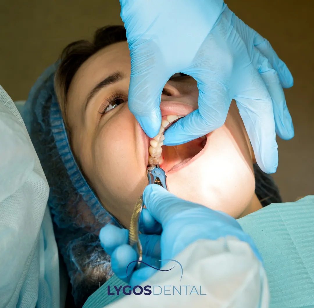 When is Wisdom Tooth Extraction Necessary