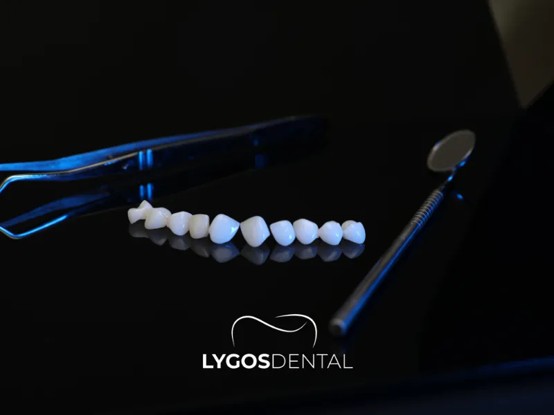 Trattamenti odontoiatrici in Turchia | LYGOS DENTAL