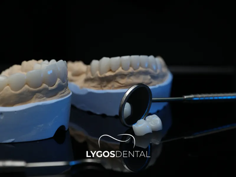 Cos’è la tendenza dei “denti da tacchino”? | LYGOS DENTAL