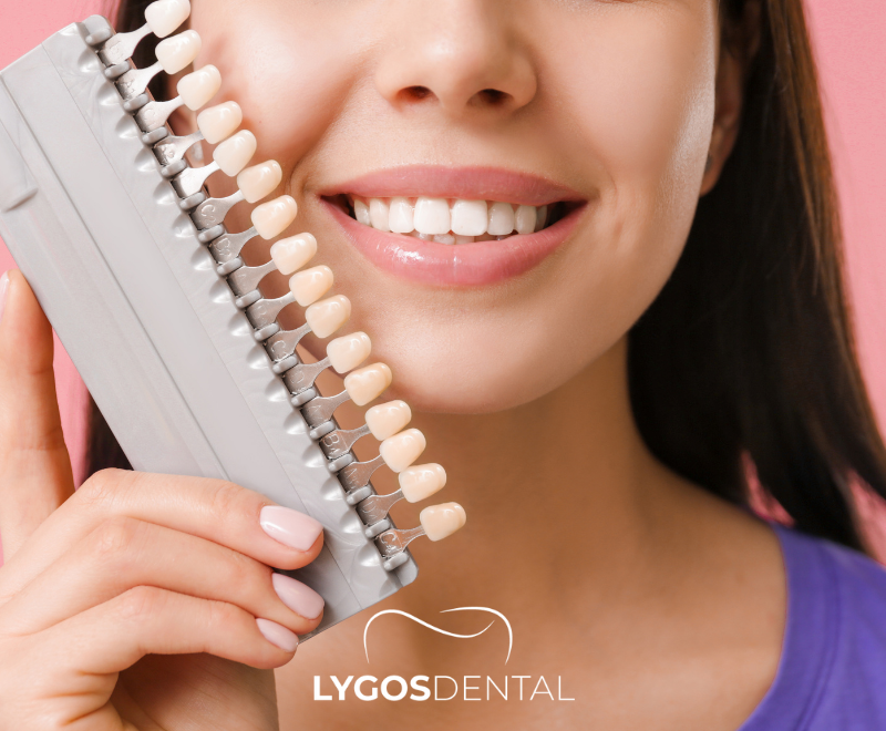 Laminate Veneers in Turkey | LYGOS DENTAL 2024