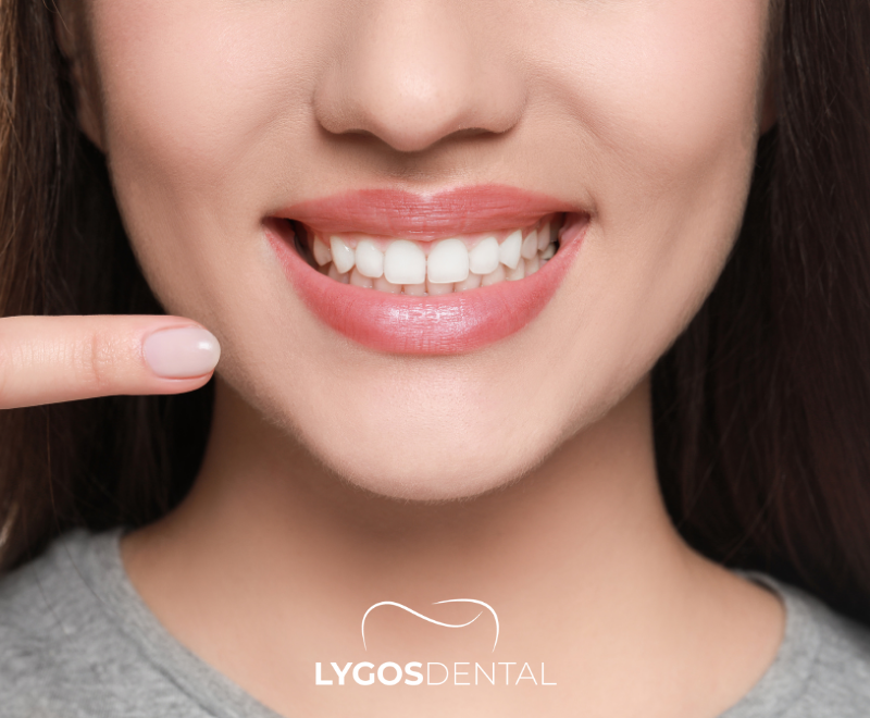 Pink Aesthetics | LYGOS DENTAL 2024