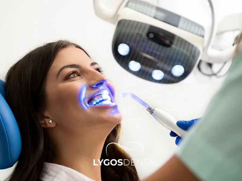 Efectos secundarios de los productos para blanquear los dientes | LYGOS DENTAL