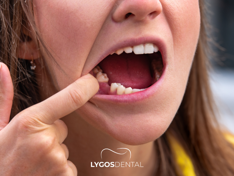 What Happens if a Tooth Is Swallowed | LYGOS DENTAL 2025