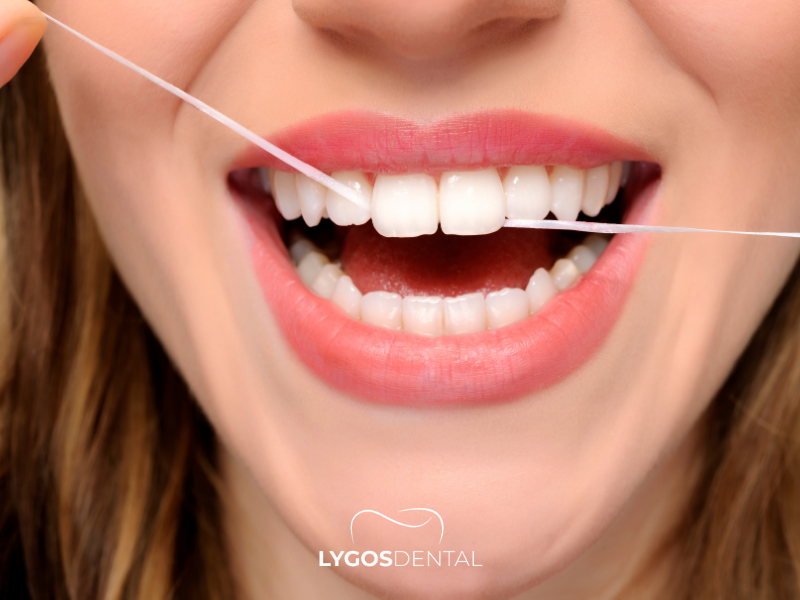 Why Do I Need to Floss | LYGOS DENTAL 2025