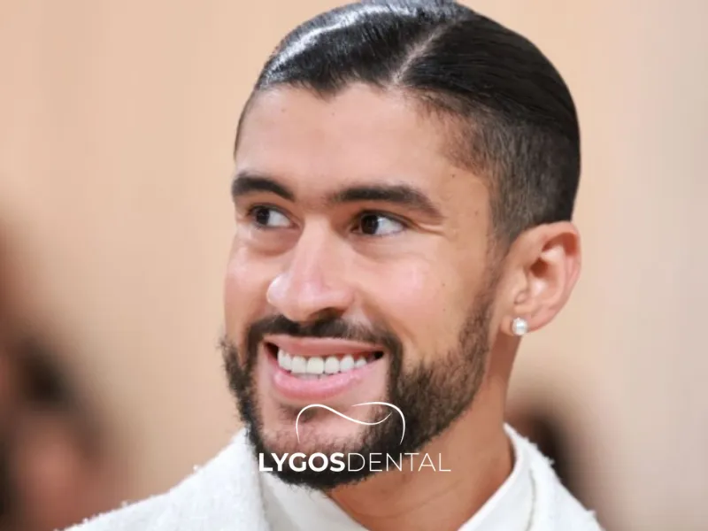 Benito Antonio Zahnästhetik | LYGOS DENTAL