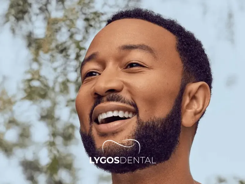 Faccette dentali di John Legend