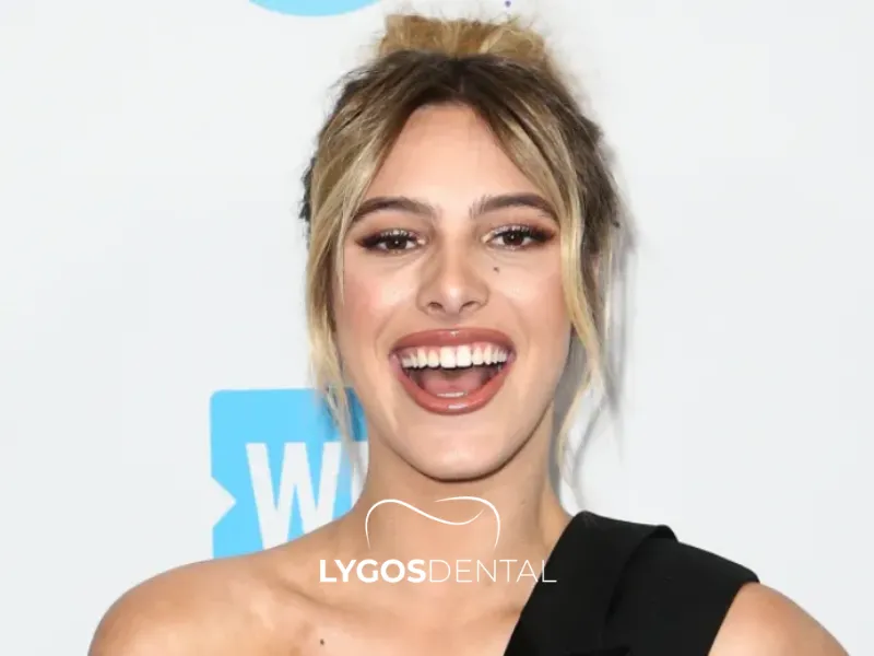 Lele Pons Estetica dentale | LYGOS DENTAL