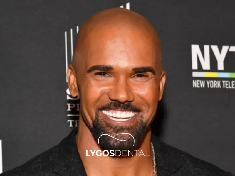 Faccette dentali di Shemar Moore
