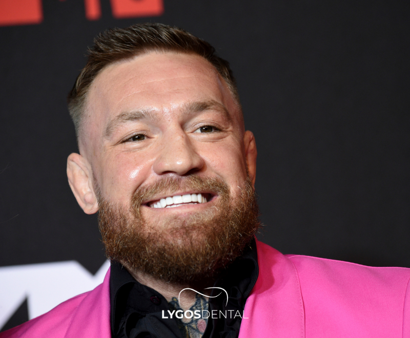 Connor McGregor Teeth Veneers | LYGOS DENTAL 2025