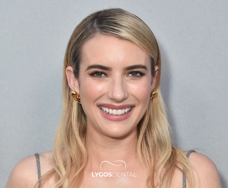 Emma Roberts Dental Aesthetic | LYGOS DENTAL