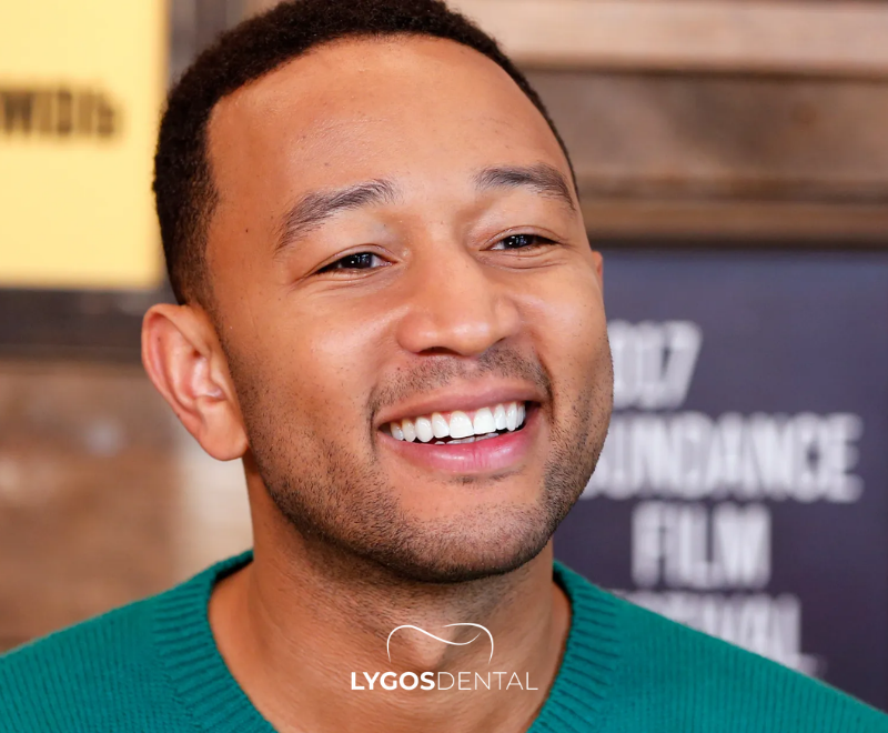 John Legend Teeth Veneers | LYGOS DENTAL