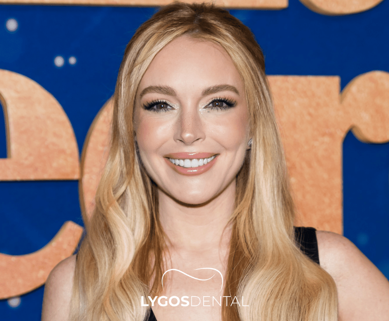 Lindsay Lohan Dental Aesthetics | LYGOS DENTAL 2025