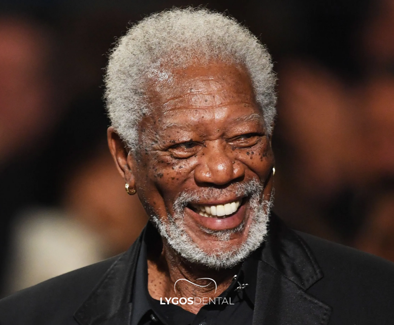 Morgan Freeman Diş Estetiği | LYGOS DENTAL