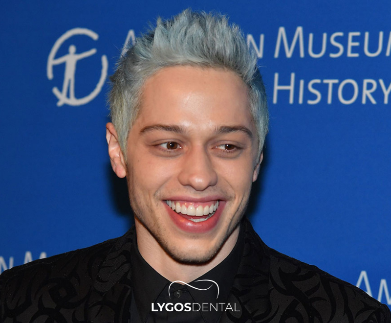 Pete Davidson Teeth Veneers | LYGOS DENTAL 2025