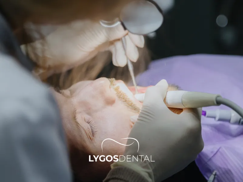 Come si esegue la pulizia del tartaro?