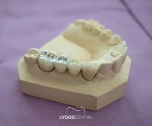 Amalgam Dolgu Nedir? | LYGOS DENTAL