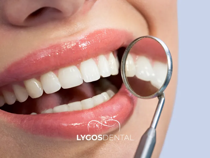 Косметические стоматологические процедуры, которые могут улучшить вашу улыбку | LYGOS DENTAL