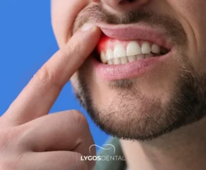 Diş Eti Ağrısına Ne İyi Gelir? | LYGOS DENTAL