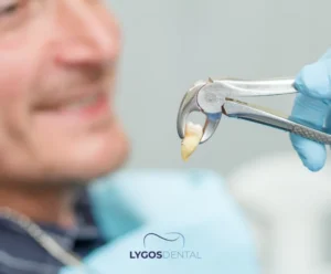Diş Çekimi Öncesi ve Sonrası Dikkat Edilmesi Gerekenler | LYGOS DENTAL