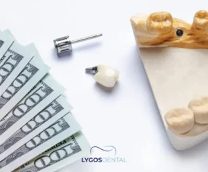 Üst Çene İmplantı Fiyatları | LYGOS DENTAL