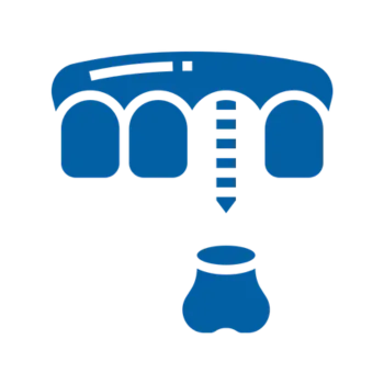 3 on 6 dental implant