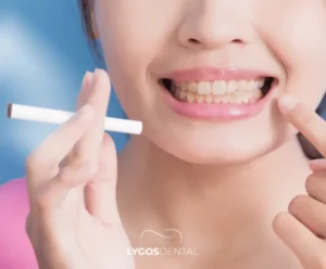 Ağız Diş Sağlığında Sigara Kullanımının 5 Ciddi Zararı | LYGOS DENTAL
