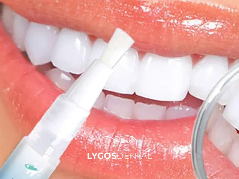 Lápiz blanqueador dental