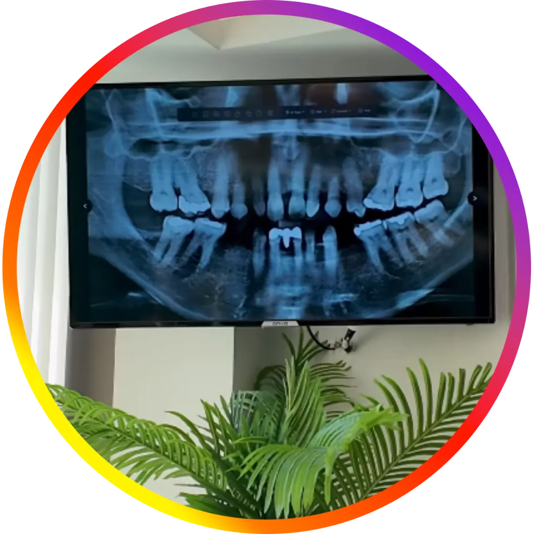 dental implant instagram reels