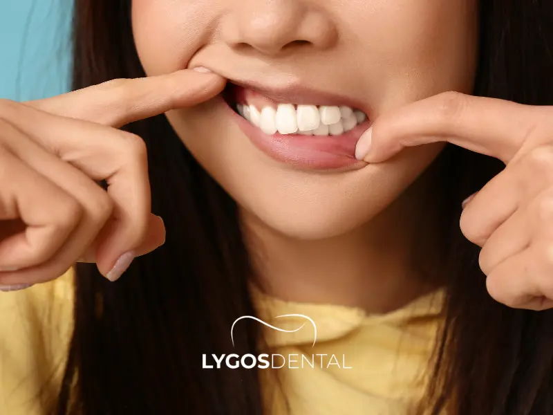 La salute delle gengive prima delle faccette in ceramica