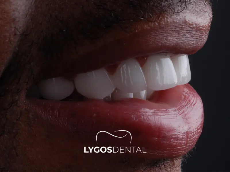 Il sorriso hollywoodiano e i social media