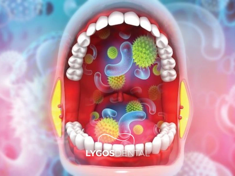 ¿Cómo proteger tu microbioma bucal?