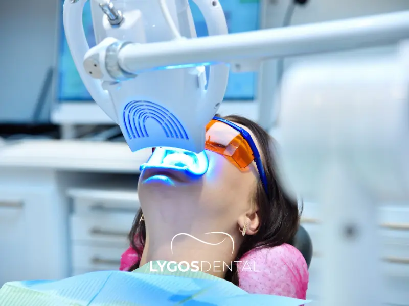 Procedura e prezzi dello sbiancamento dentale con laser in studio