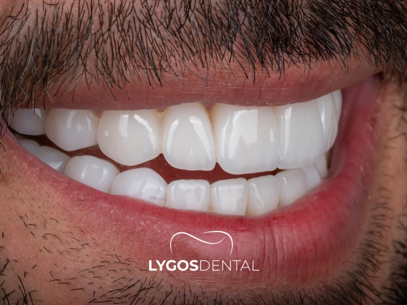 I metodi di odontoiatria estetica più apprezzati nel 2026