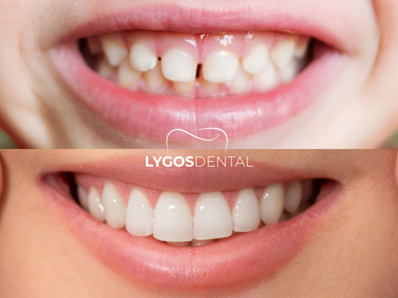 Cambios en la estructura dental según la edad