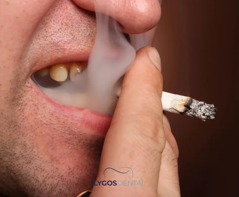How to Prevent Gum Recession in Smokers?
