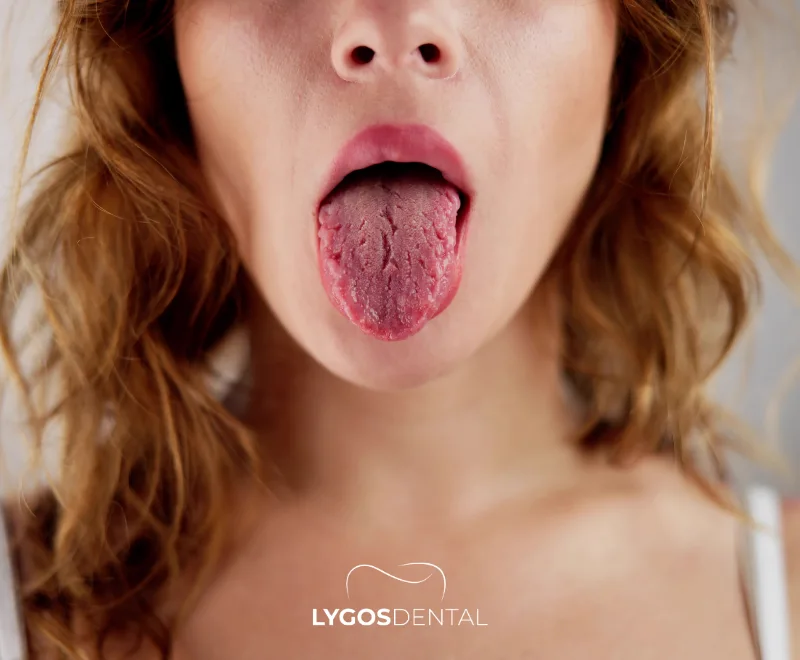 What Is Good for Dry Mouth?