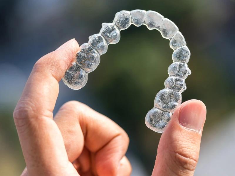 Invisalign-Preise in der Türkei im Vergleich zum Vereinigten Königreich | LYGOS DENTAL