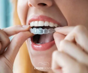 Invisalign Fiyatları Türkiye ve İngiltere | LYGOS DENTAL