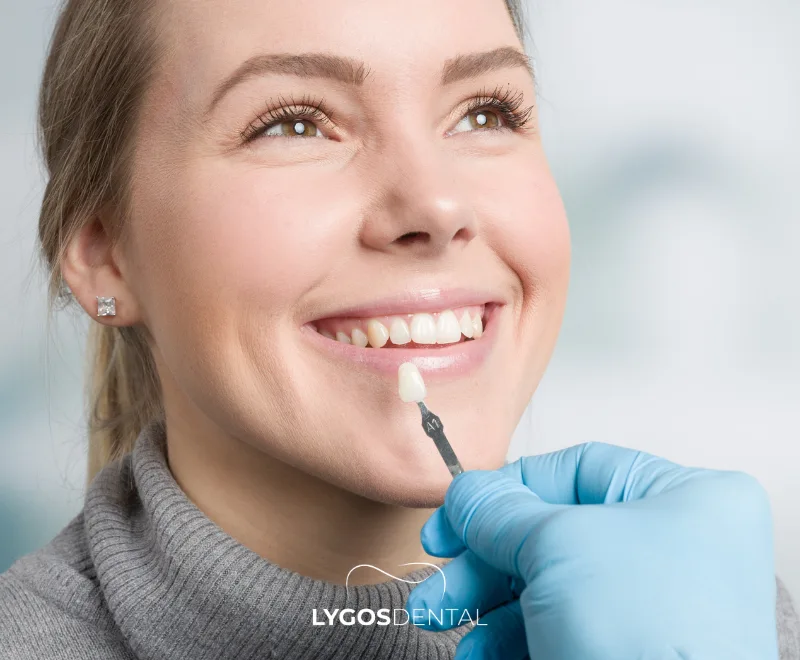 Porcelain Veneers in Turkey vs Spain