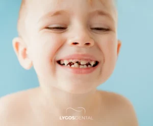 Methods to Prevent Baby Tooth Decay | LYGOS DENTAL