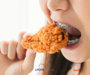 What to Eat During Orthodontic Treatment | LYGOS DENTAL