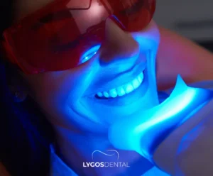 Laser Teeth Whitening | LYGOS DENTAL