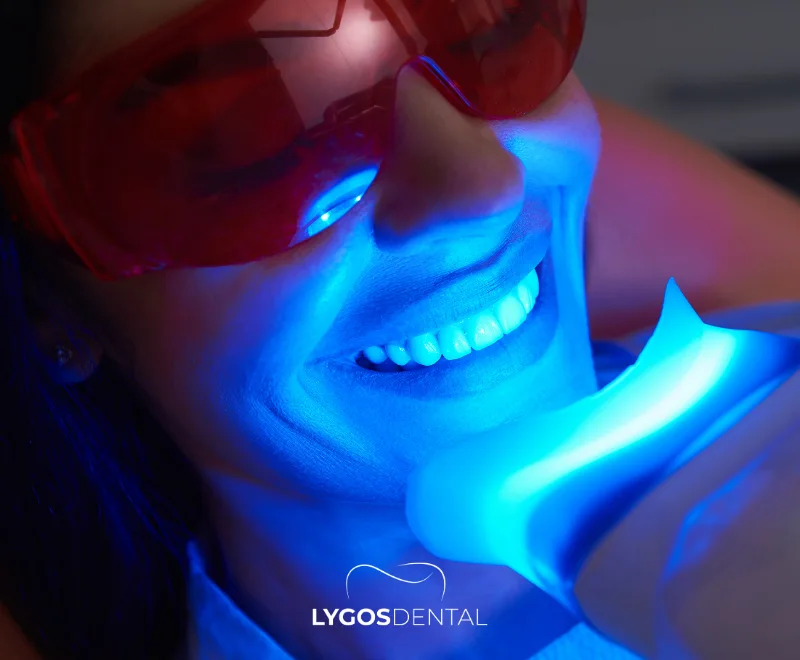 Laser Teeth Whitening