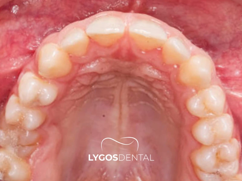 Arco alveolare: il suo ruolo nella salute e nella funzionalità orale