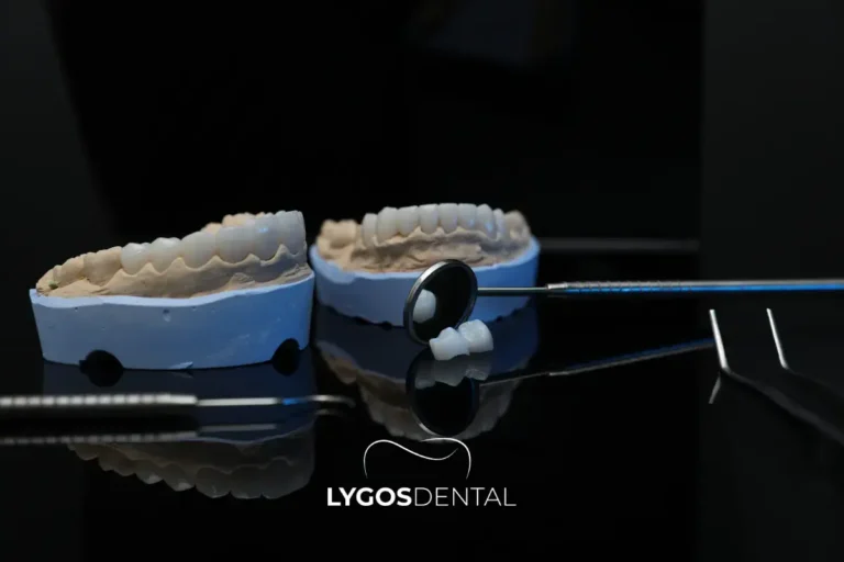 Common Dental Treatments People Come for