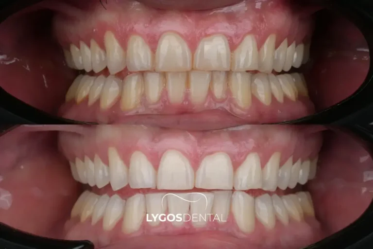 Getting a result that looks natural