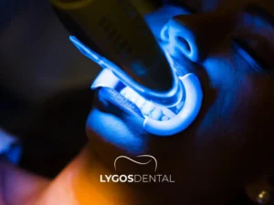 Tooth Whitening What We Now Know