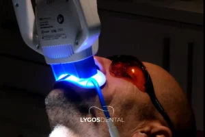 Tooth Whitening: What We Now Know